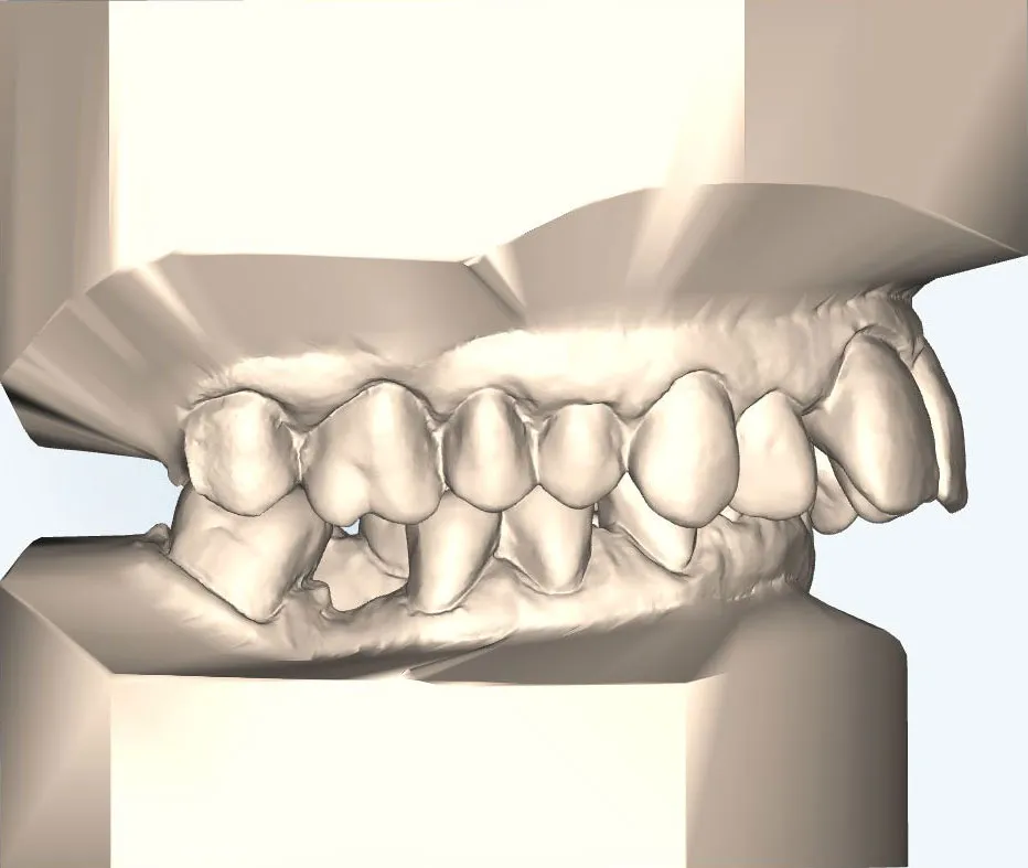 3D-Modell der Zähne für chirurgische Planung