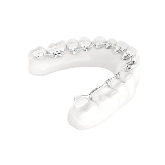 WIN-Bracket Lingualtechnik Modell